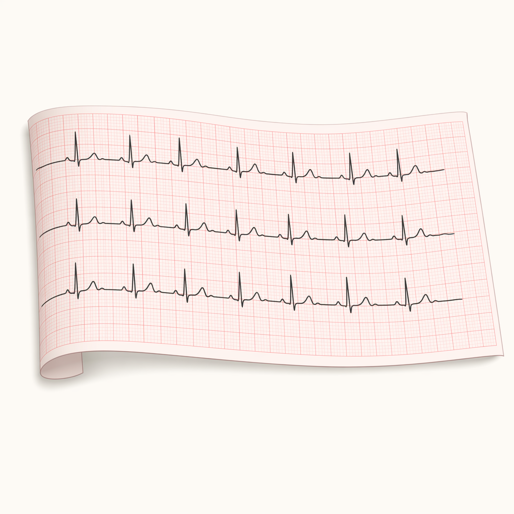 ECG