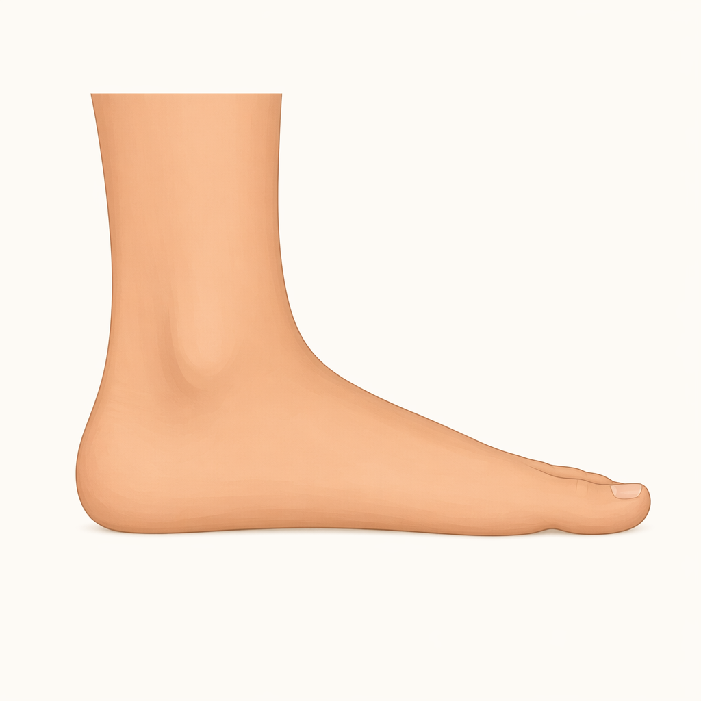 flatfoot