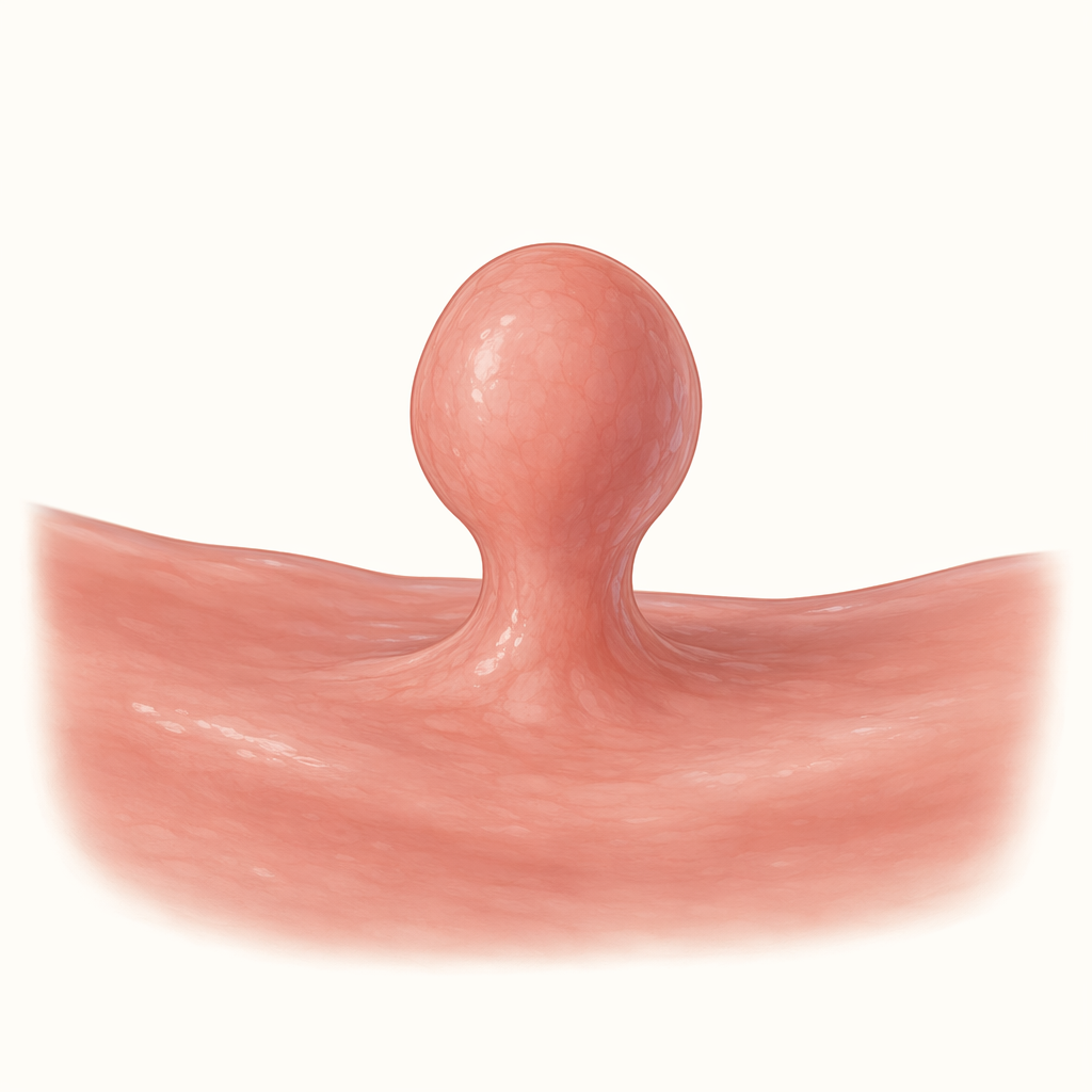 polyp