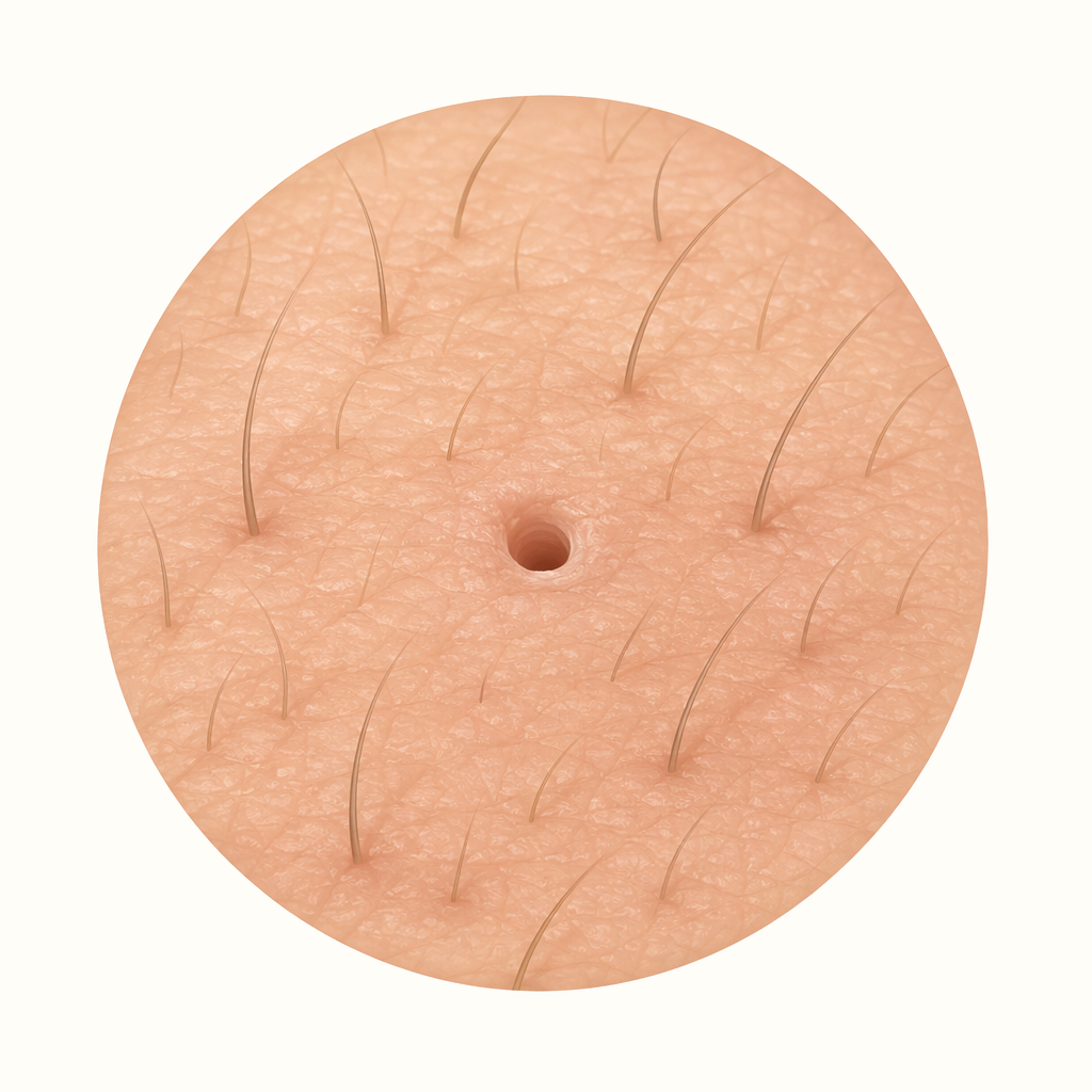 pore