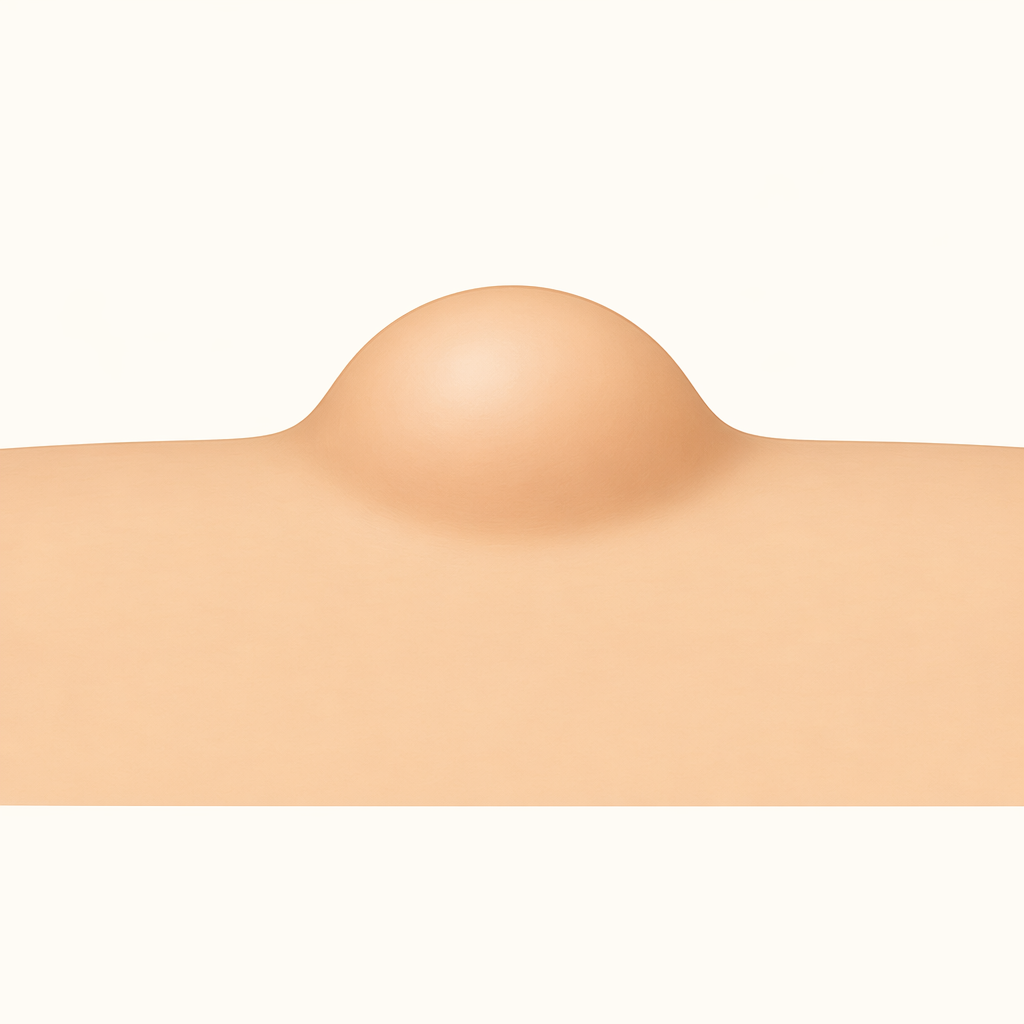 protuberance