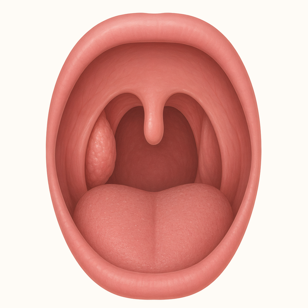 tonsil